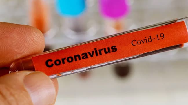 Koronavirusun isti havada məhv olması ilə bağlı yeni açıqlama