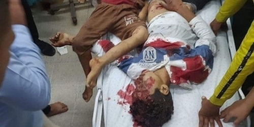 İsrail rejimi Qəzzada qətliama başladı: 9-u uşaq olmaqla 20 şəhid, 65 yaralı var